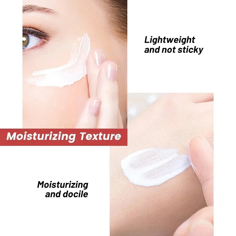 1/3/5 pièces crème blanchissante pour les taches de rousseur Niacinamide élimine les taches foncées crème Anti-taches de rousseur et vieillissement estompe Pigmentation Melasma peau