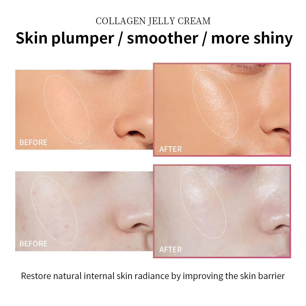 Crème hydratante à la gelée de collagène Niacinamide Collagène hydrolysé Raffermissant Apaisant Anti-âge Fermeté Hydratation Soins de la peau