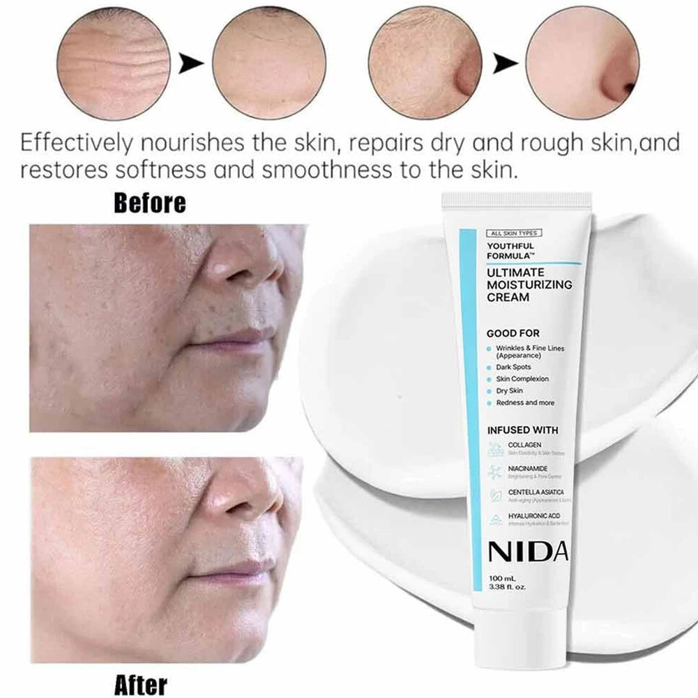 Korea Nida Crème hydratante ultime Soins quotidiens de la peau du visage Resserrer les pores rétrécir Améliorer les ridules Rajeunir la peau du visage