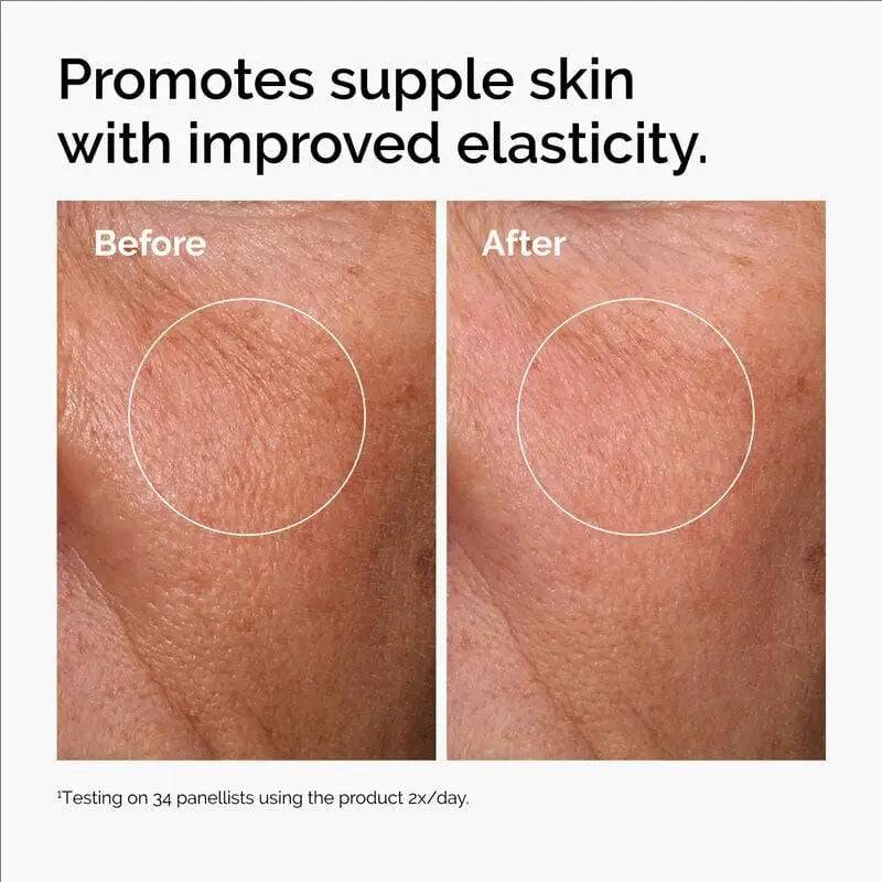 Acide hyaluronique 2 % + sérum hydratant B5 avec essence de céramides liquides de décoloration des lignes fines raffermissent et nourrissent la peau sensible 30ML