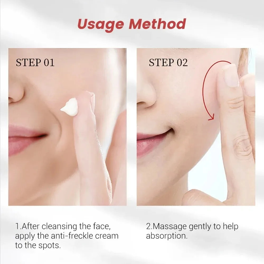 1/3/5 pièces crème blanchissante pour les taches de rousseur Niacinamide élimine les taches foncées crème Anti-taches de rousseur et vieillissement estompe Pigmentation Melasma peau